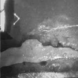 Рис. 2. Изображение кортикального слоя кости при помощи растрового микроскопа: 1 — смола; 2 — кортикальный слой кости лунки зуба; 3 — губчатый слой кости; 4 — металл